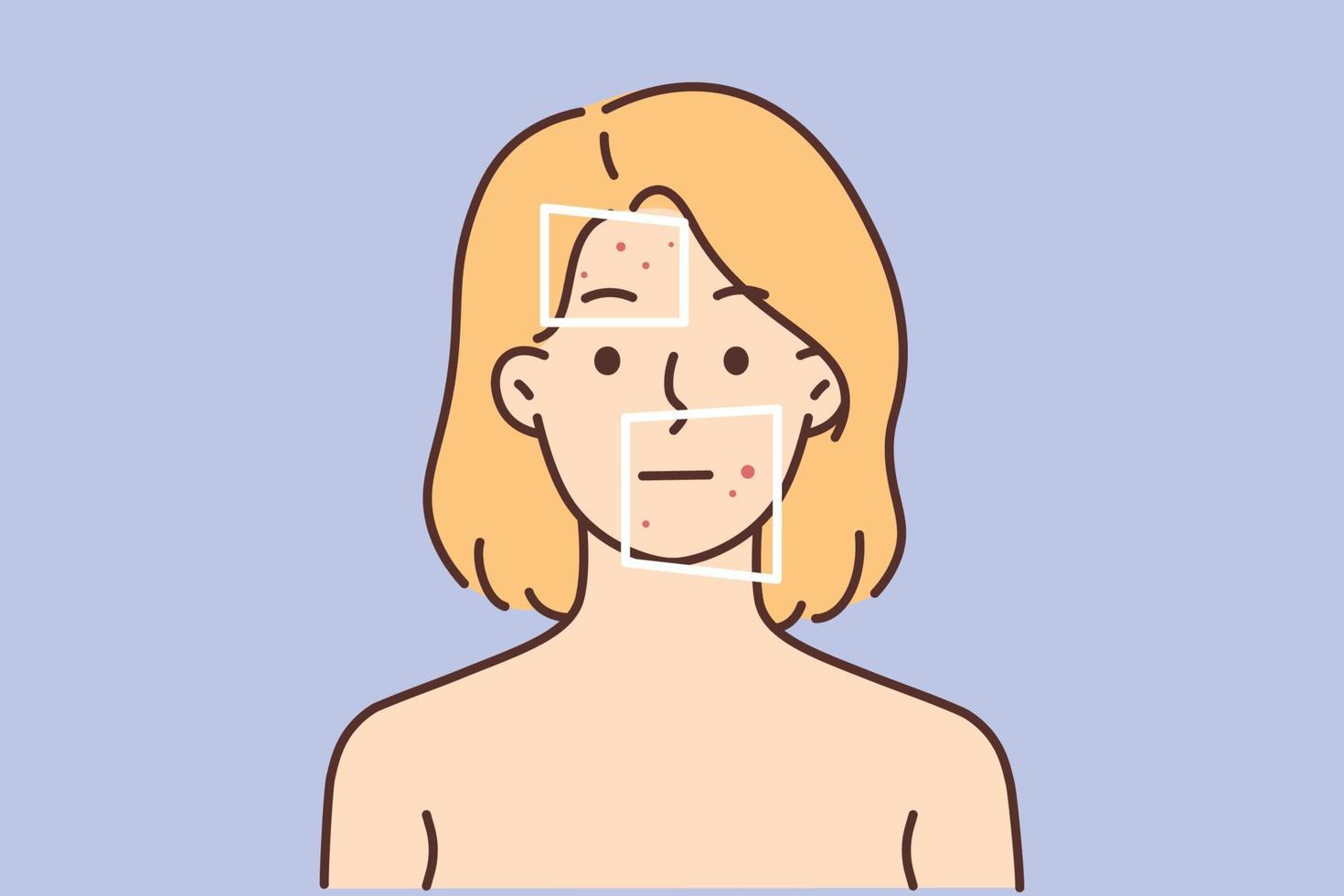 desnudo mujer con rojo espinillas en cara sufrir desde dermatitis. infeliz hembra con enrojecimiento o alergia dificil con facial problema. protección de la piel. vector ilustración.