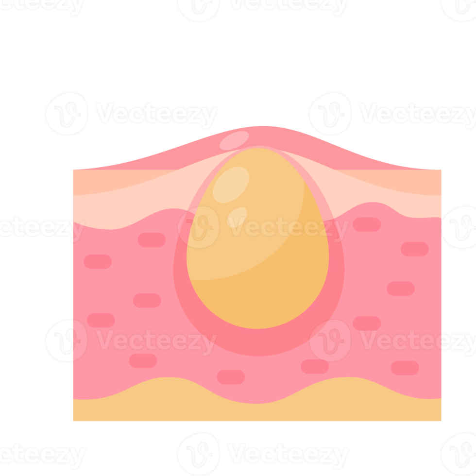 Mensch Haut Schicht Pflege zum schützen das Haut von das Sonne mit ein Haut Serum. png
