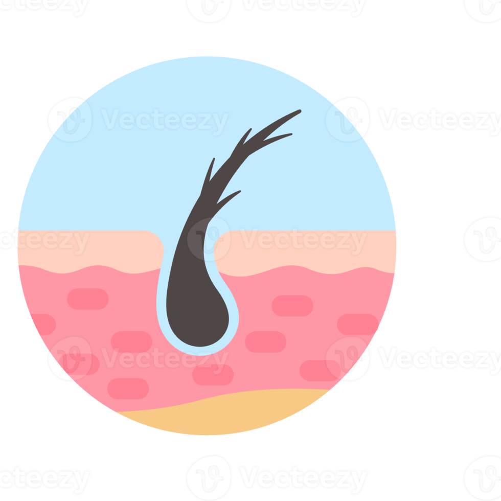 Haar Follikel auf Mensch Haut Haar Störung Haar Pflege png