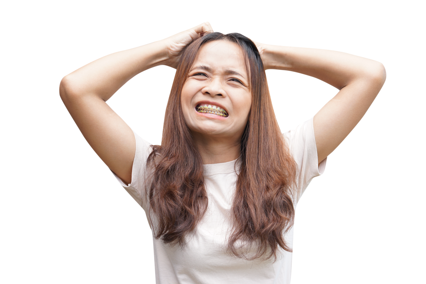 Asian woman having itchy head from dandruff png