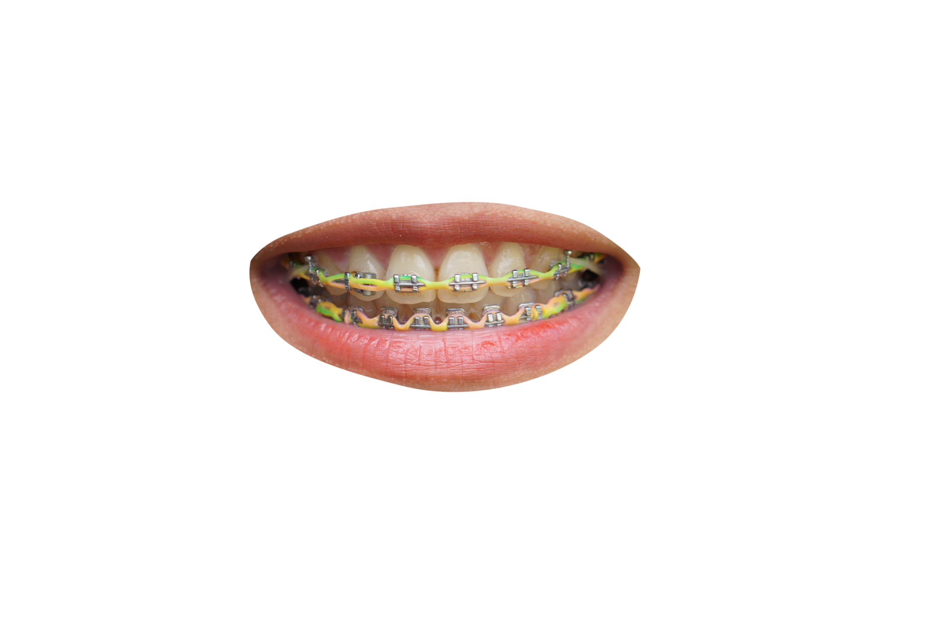 boca-con-tirantes-20952168-png