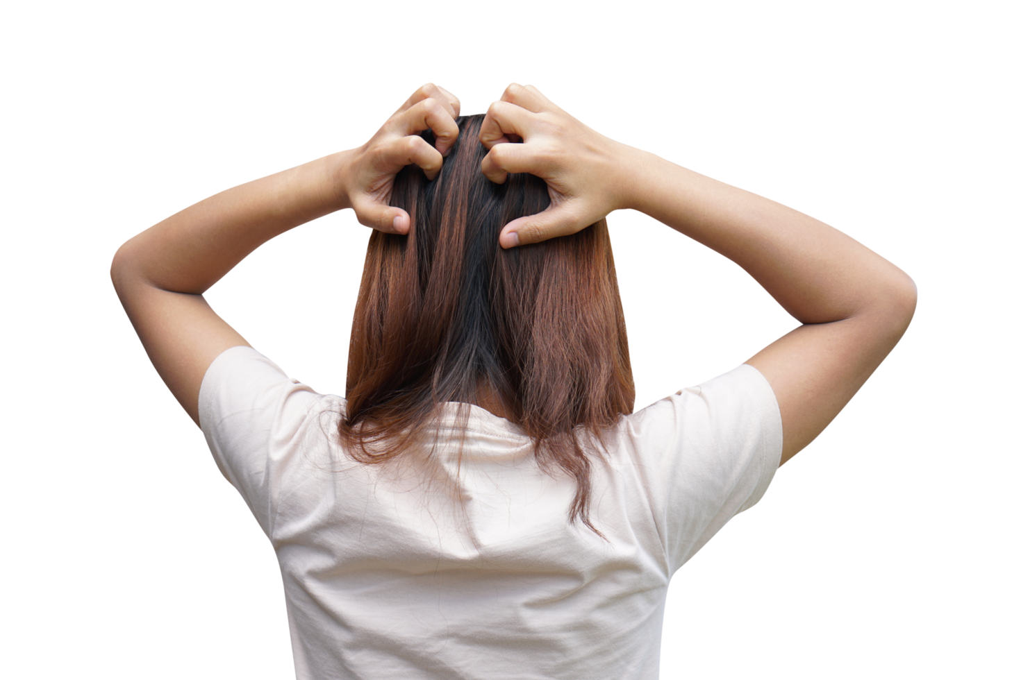 Asian woman having itchy head from dandruff png