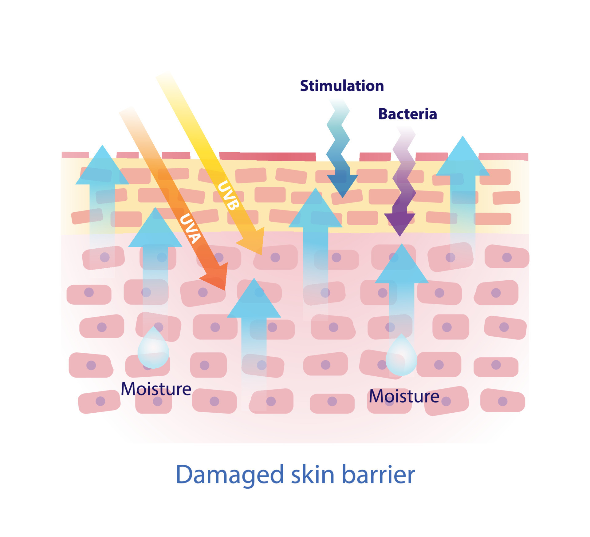 Damaged skin barrier vector on white background. The weak skin barrier