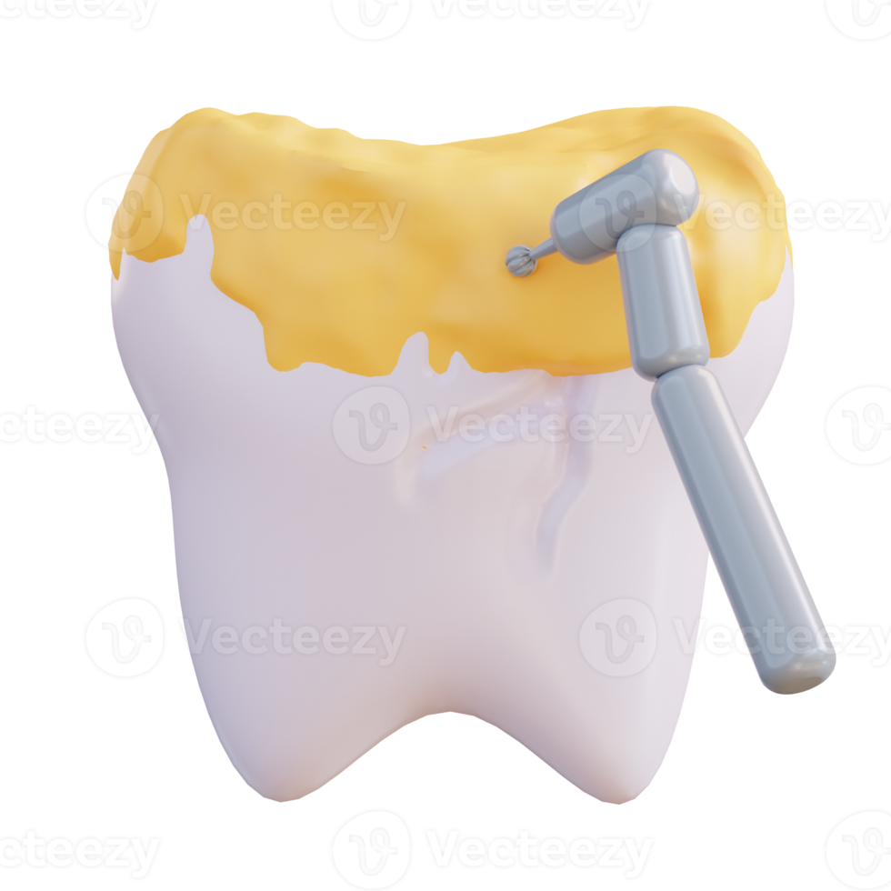 3d illustration of cleaning tooth decay with a drill png