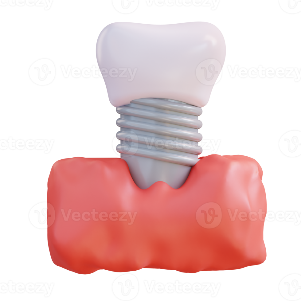 3d illustration de raccord dentiers png