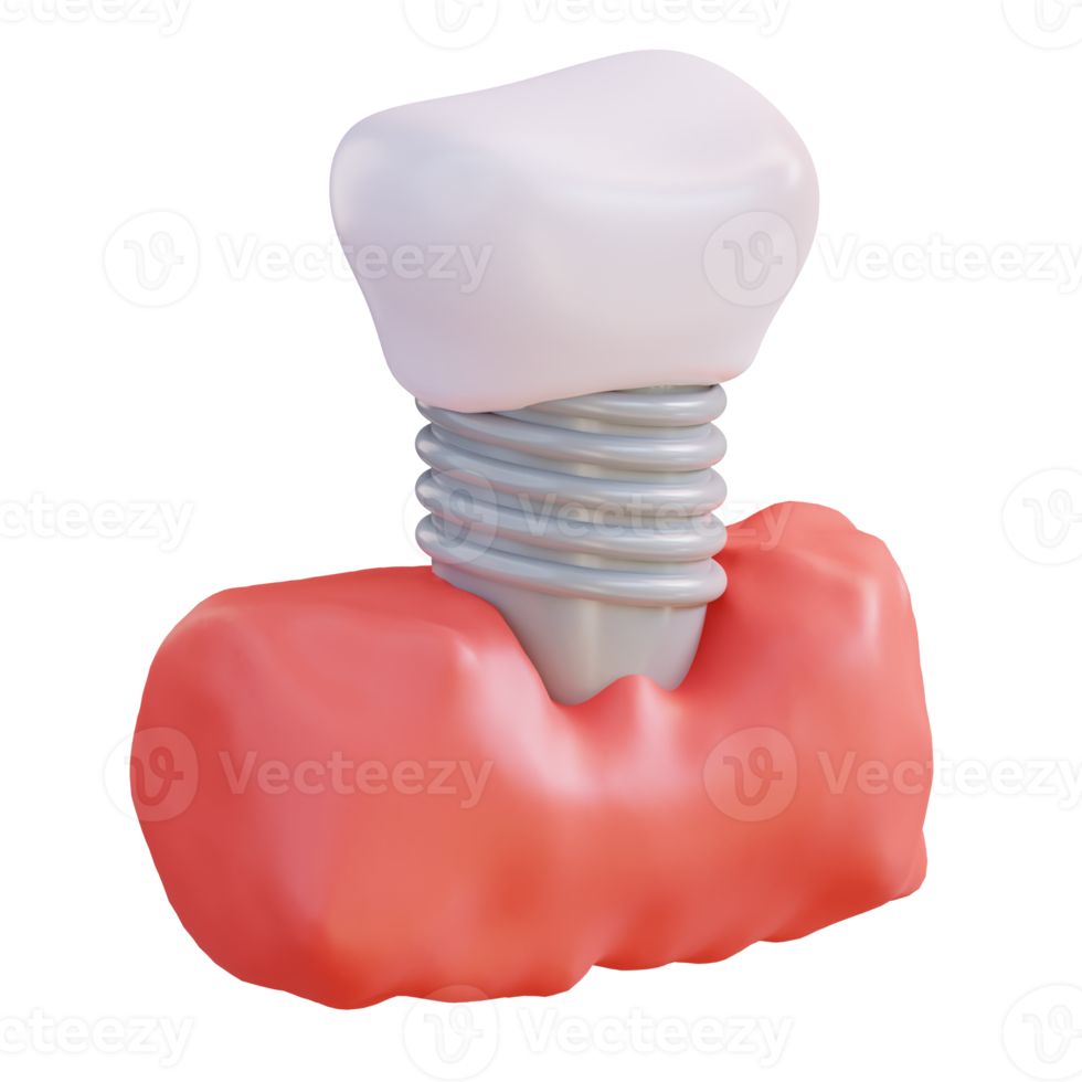 3d illustration de raccord dentiers png