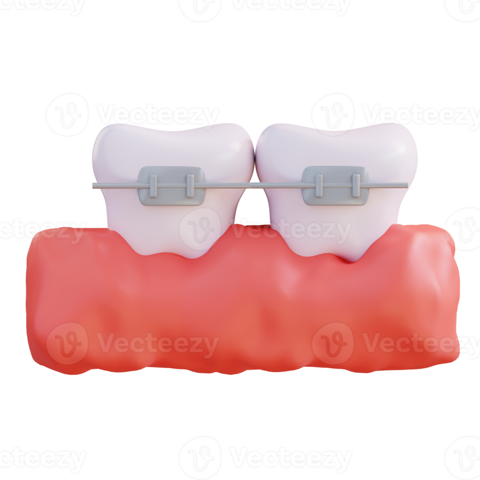 3d illustration of wearing braces png