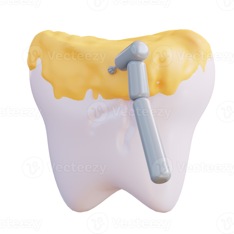 3d illustrazione di pulizia dente decadimento con un' trapano png