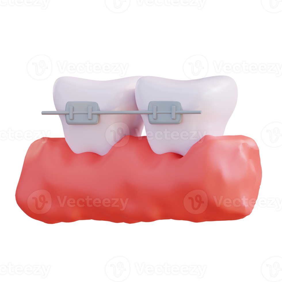 3d illustration of wearing braces png