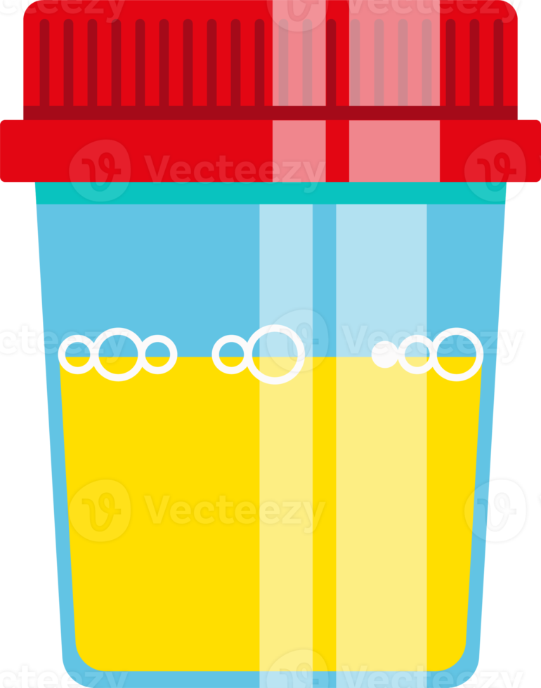 urine analyse in plastic pot met gekleurde deksel. laboratorium testen. vlak png