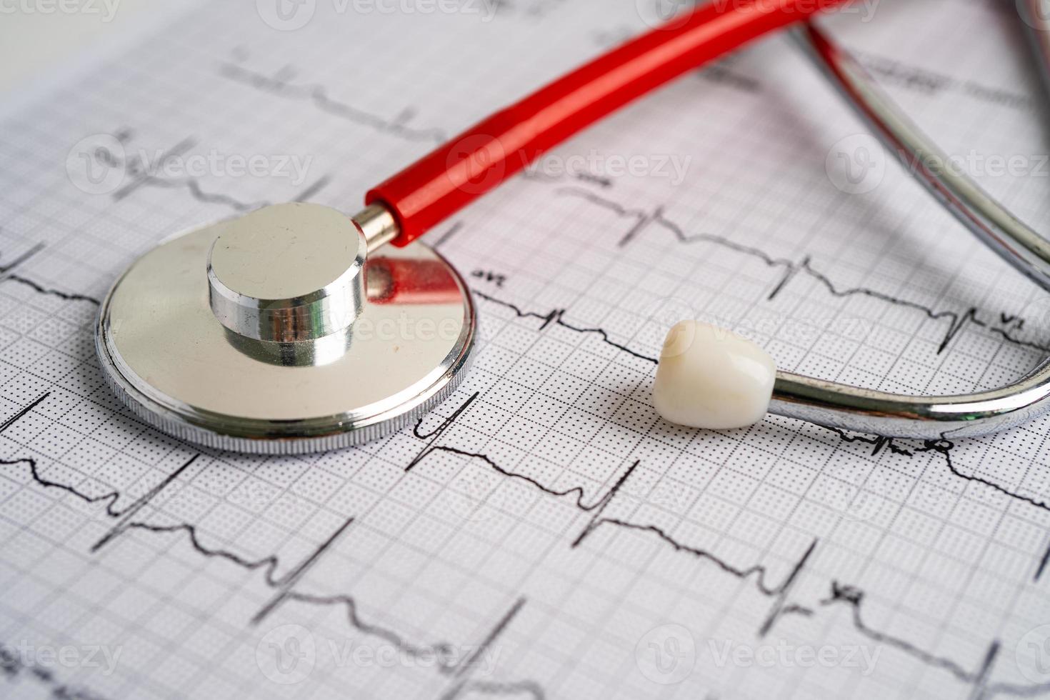 Stethoscope on electrocardiogram ECG, heart wave, heart attack, cardiogram report. photo