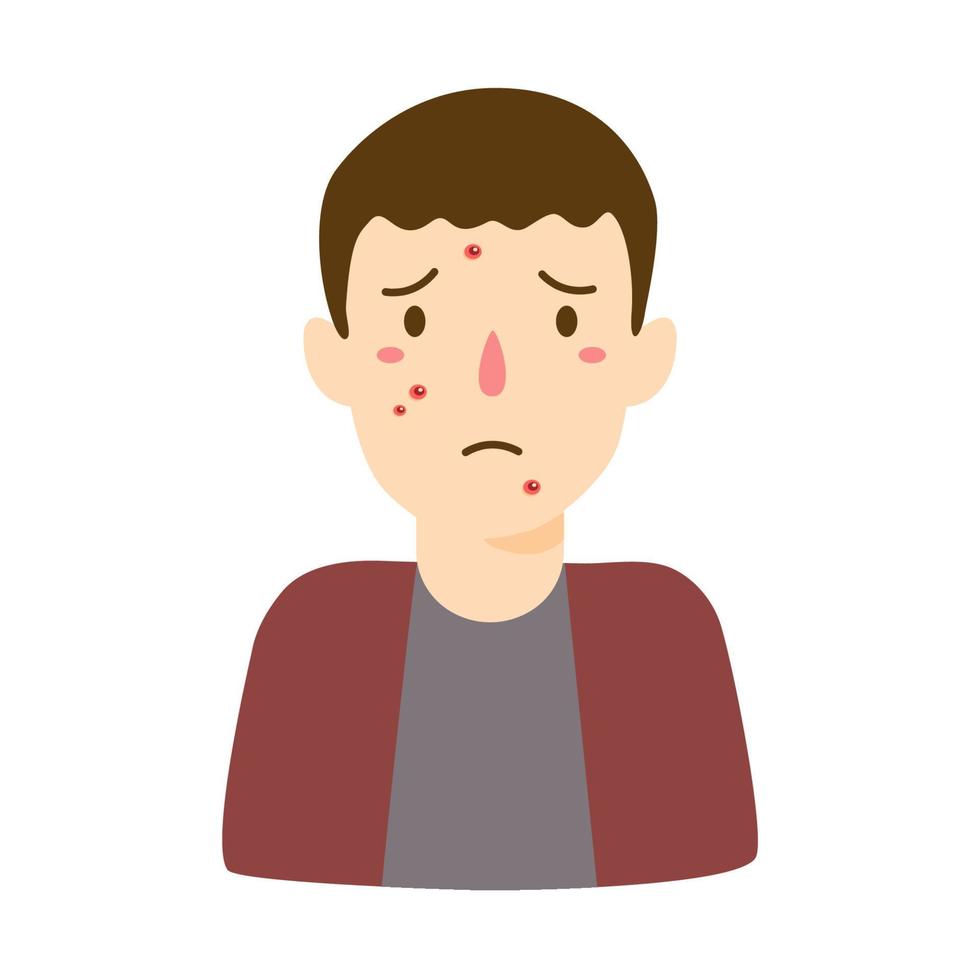 acne problem concept illustration vector