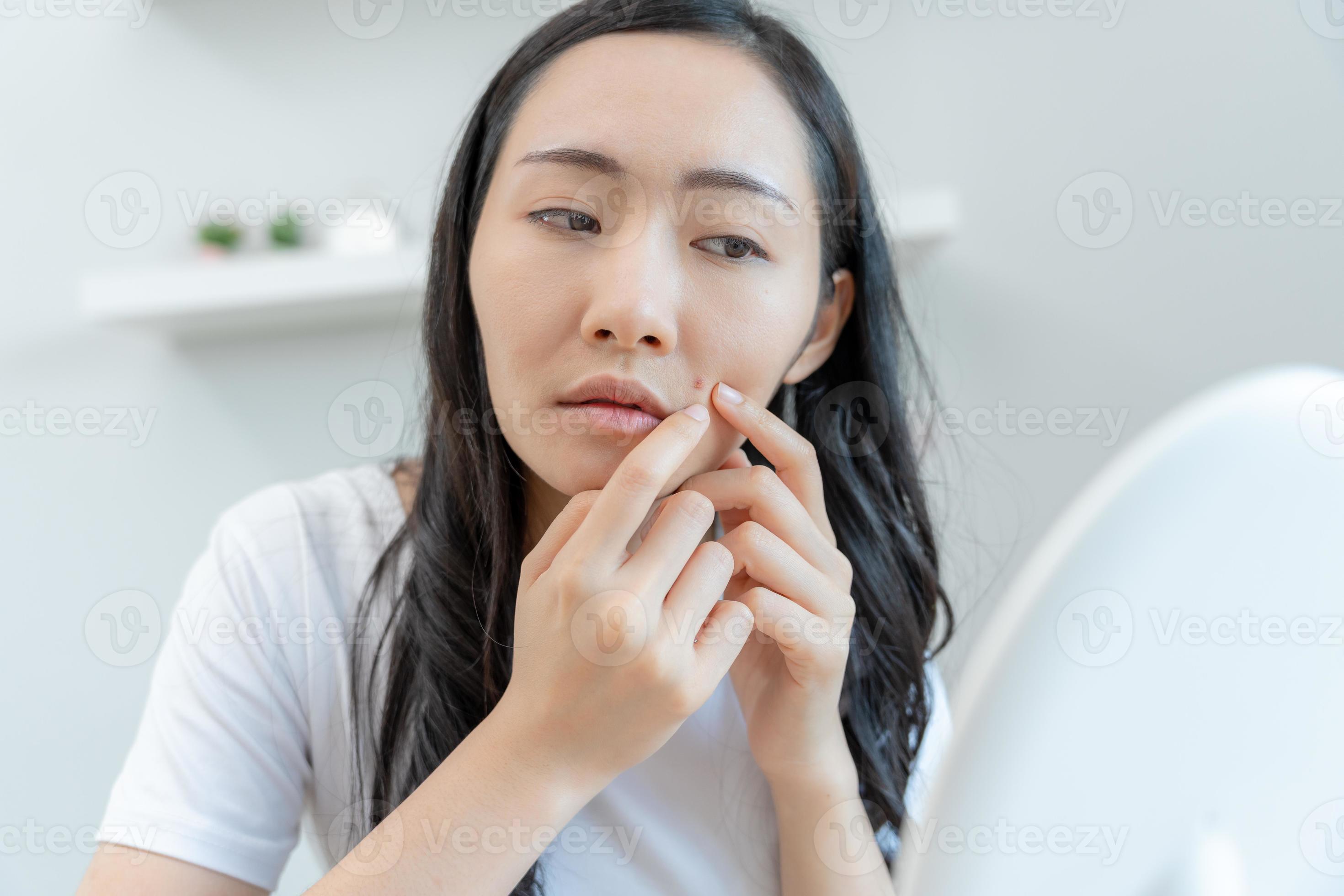 Young woman are worried about faces Dermatology and allergic to