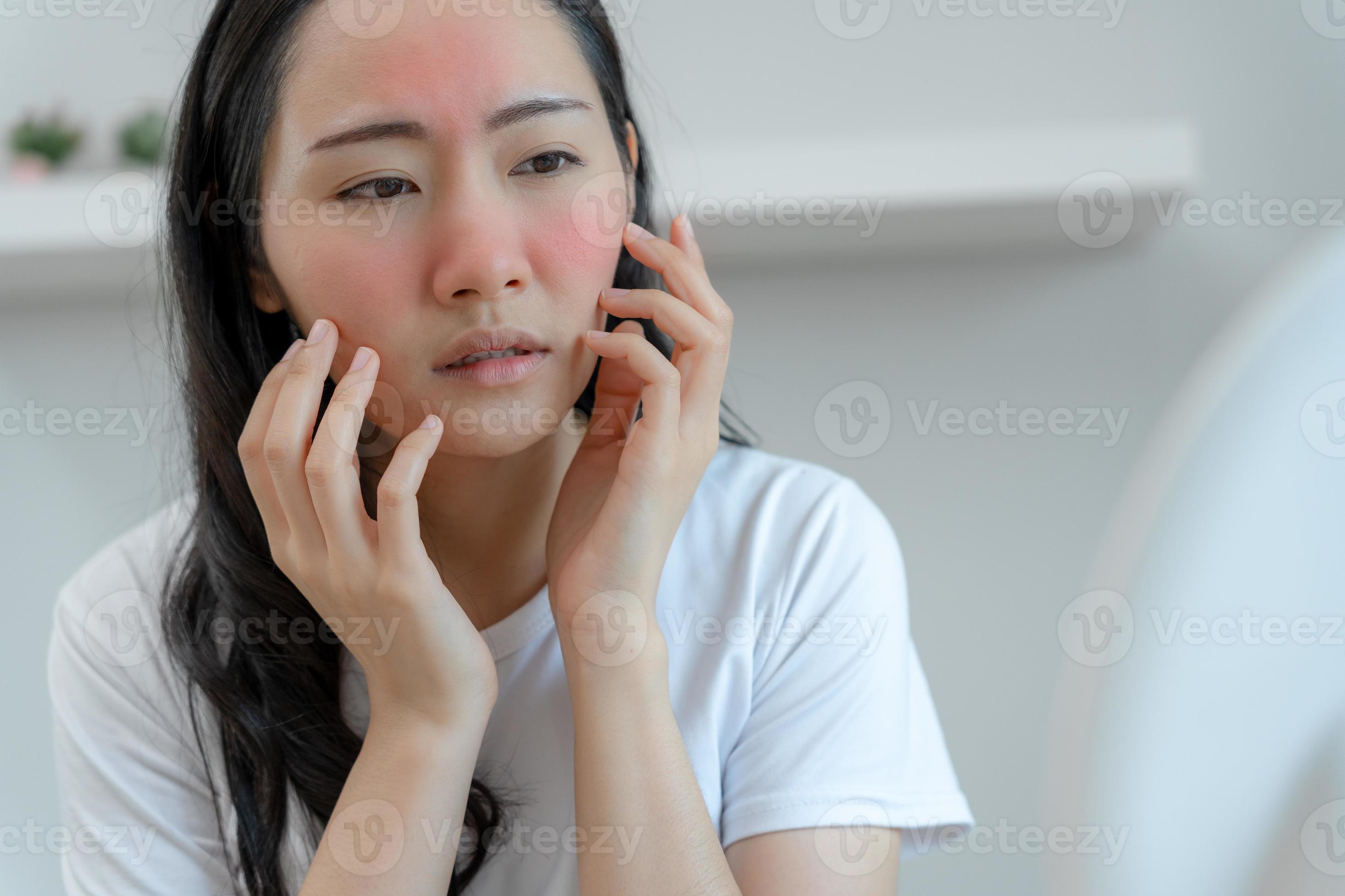 Young woman asian are worried about faces Dermatology and allergic to