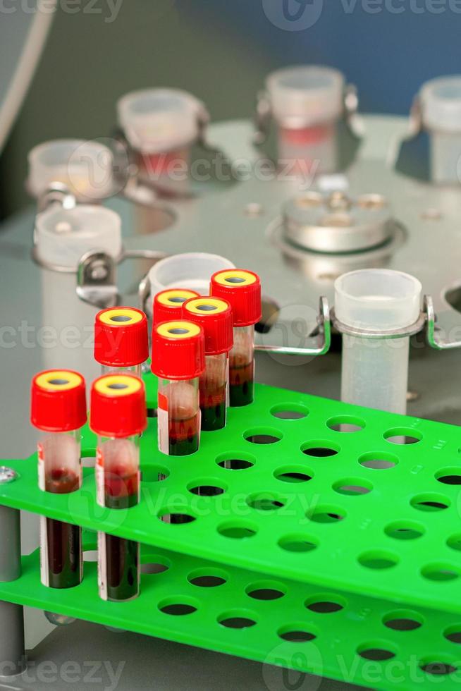 Test tubes with blood samples photo