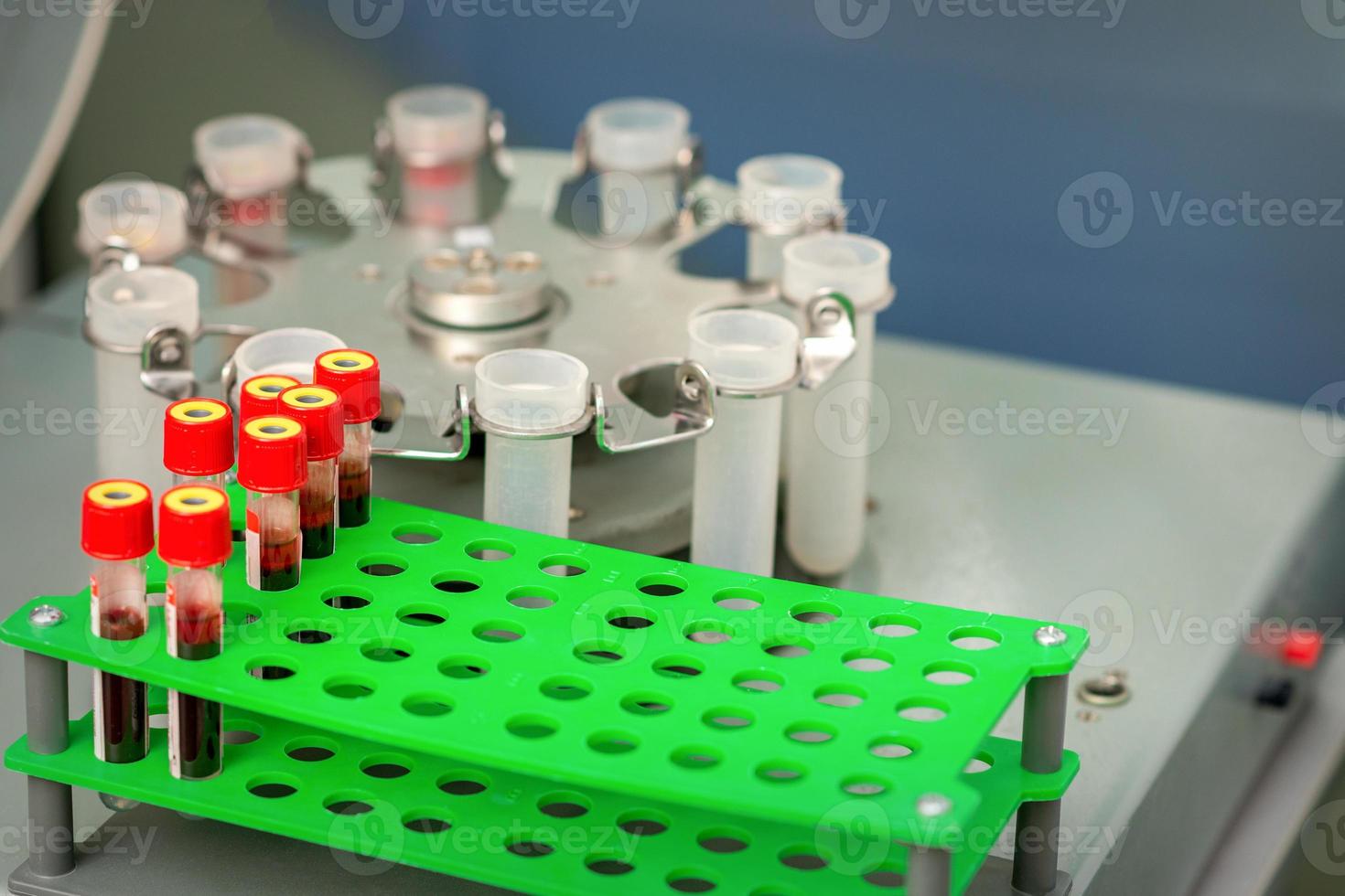 Test tubes with blood samples photo