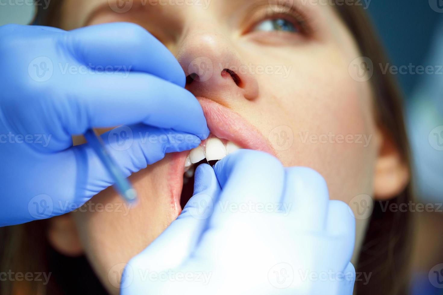 mujer consiguiendo un dental tratamiento foto