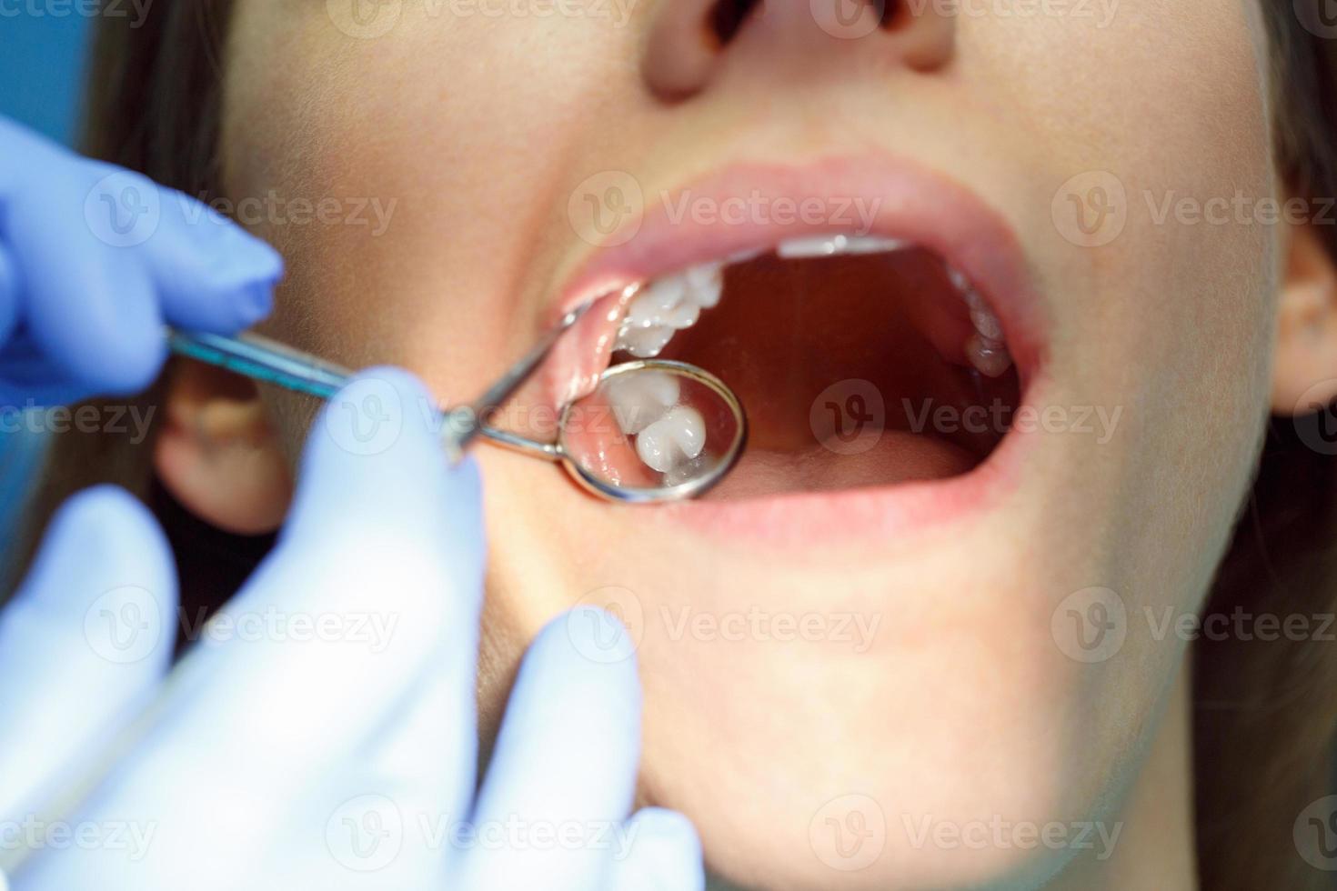 mujer consiguiendo un dental tratamiento foto