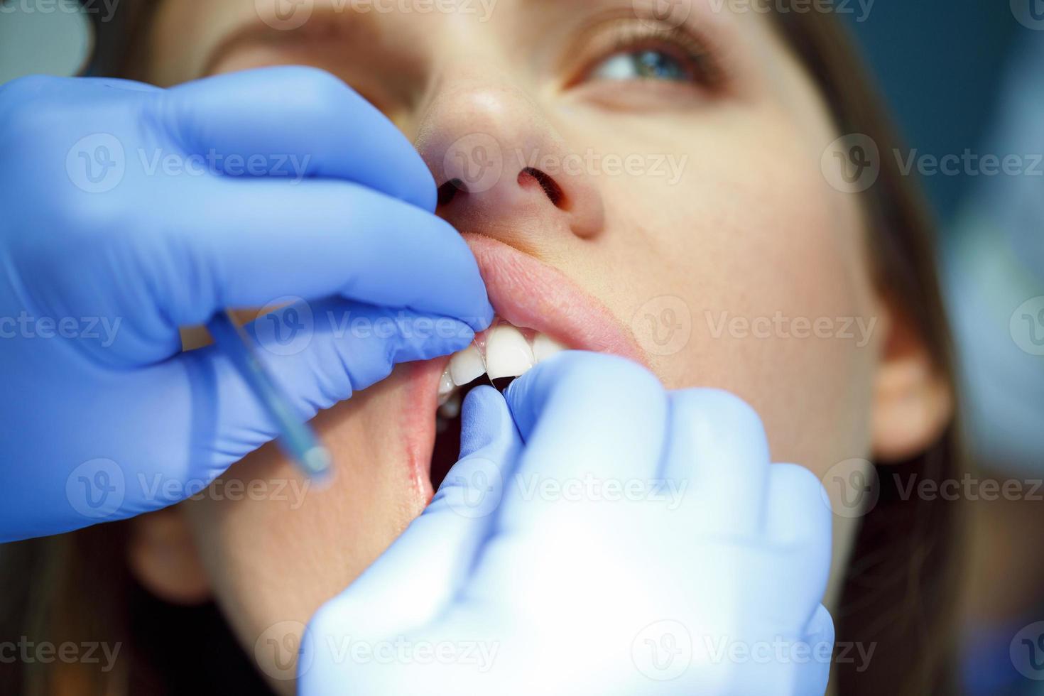 mujer consiguiendo un dental tratamiento foto