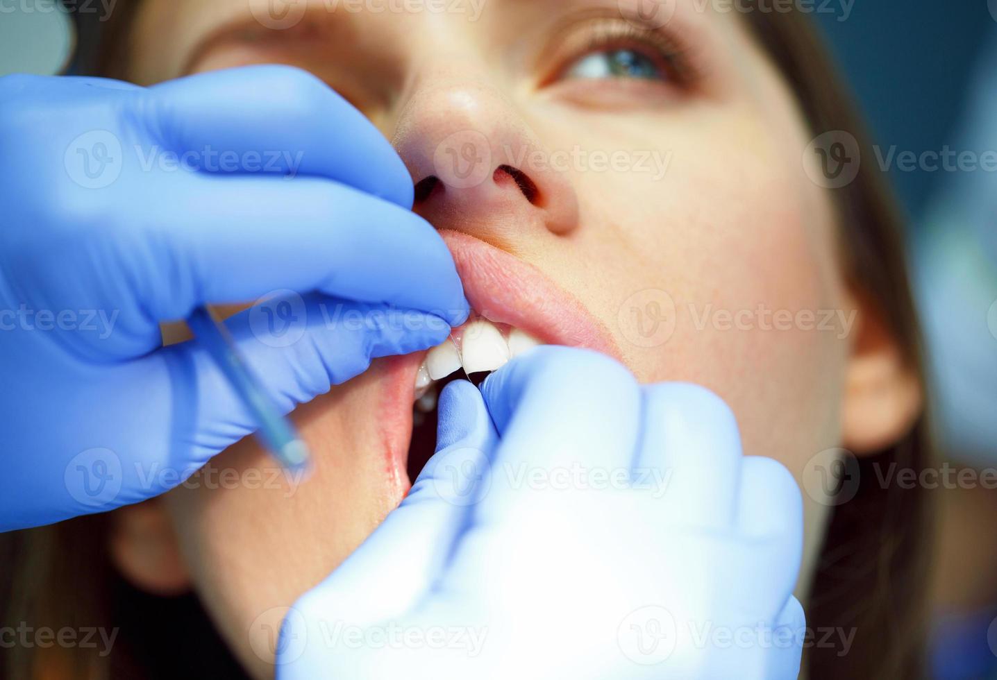 mujer consiguiendo un dental tratamiento foto