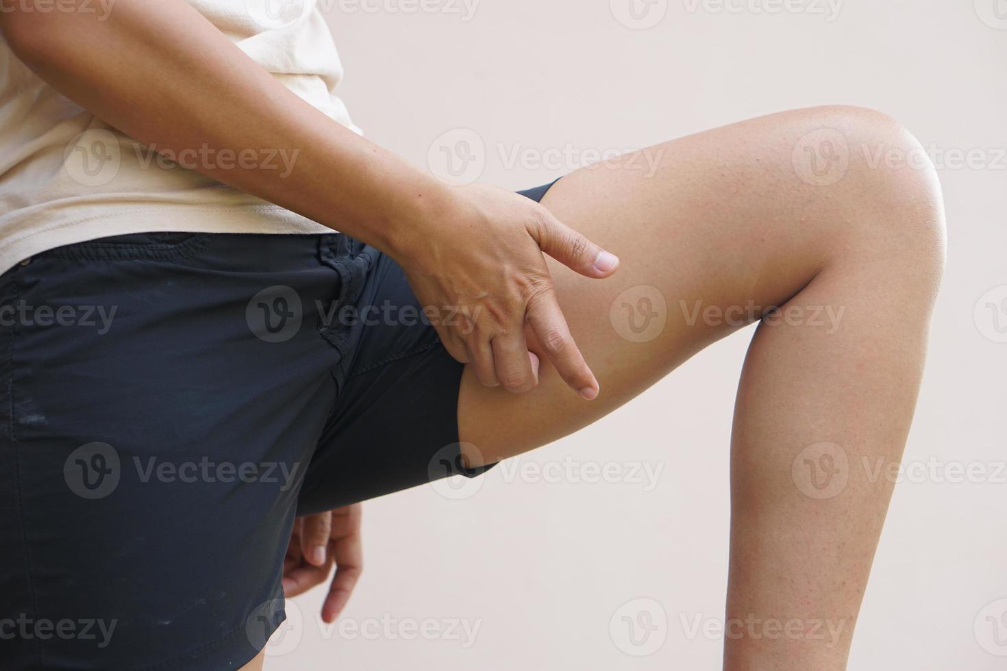 asiático mujer teniendo que produce picor piernas foto