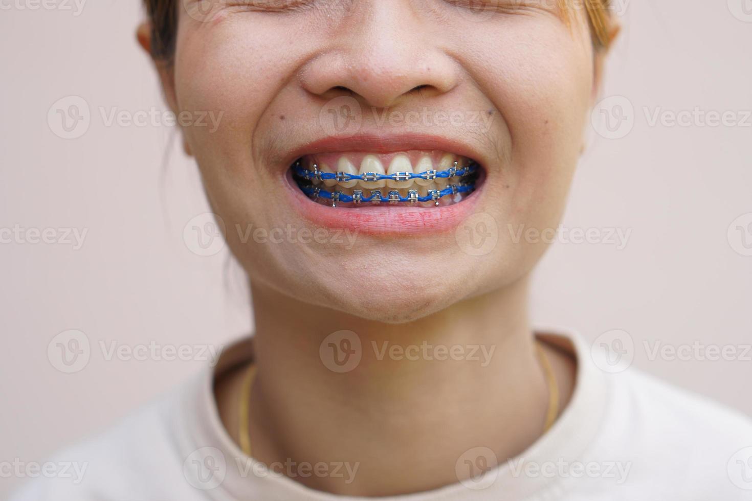 asiático mujer sonriente demostración tirantes foto