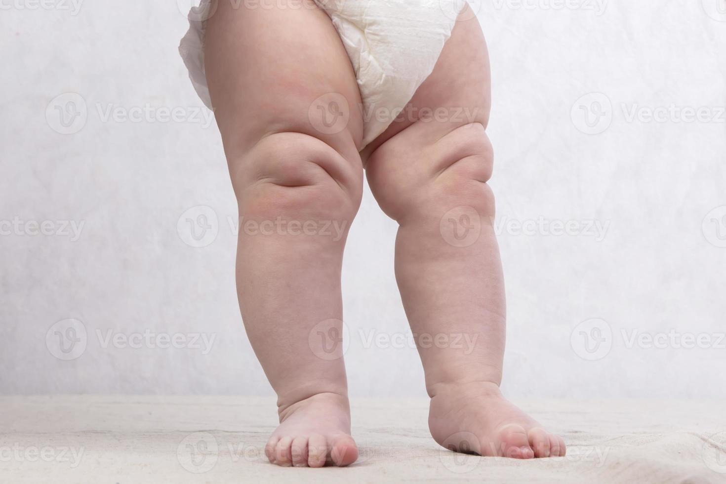 Legs of a plump newborn baby in a diaper photo