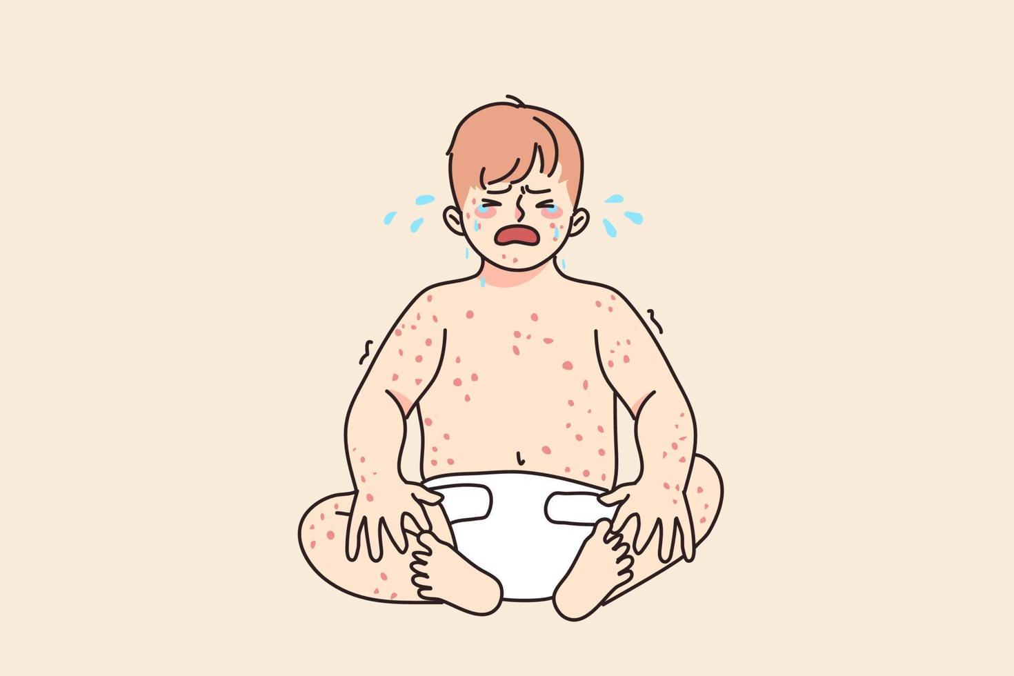 Unhappy baby infant crying suffer from eczema or dermatology disease. Upset sad little kid newborn child stressed with measles or chickenpox. Children healthcare concept. Vector illustration.