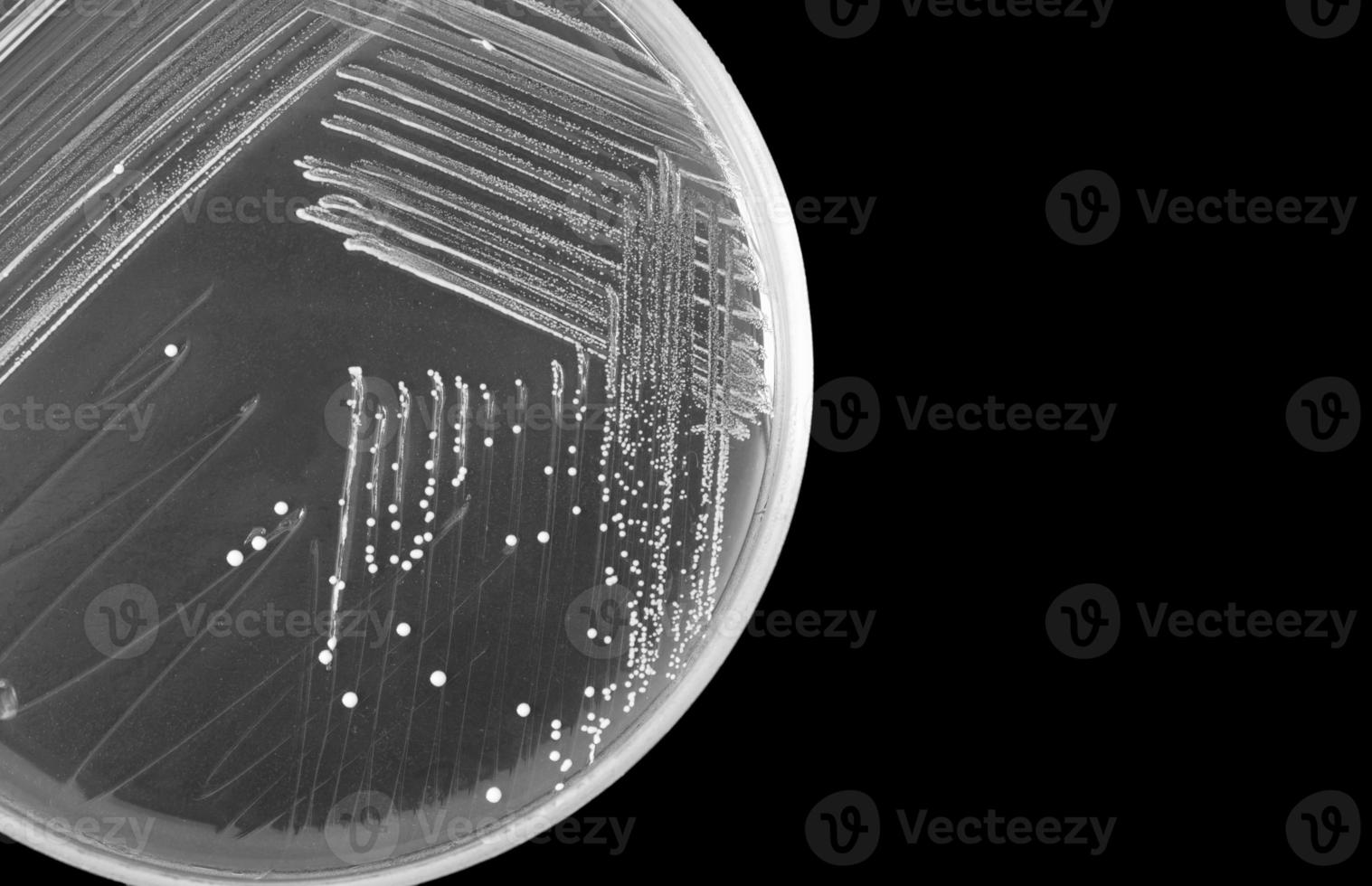 macro de bacterias en petri plato aislado en negro antecedentes foto