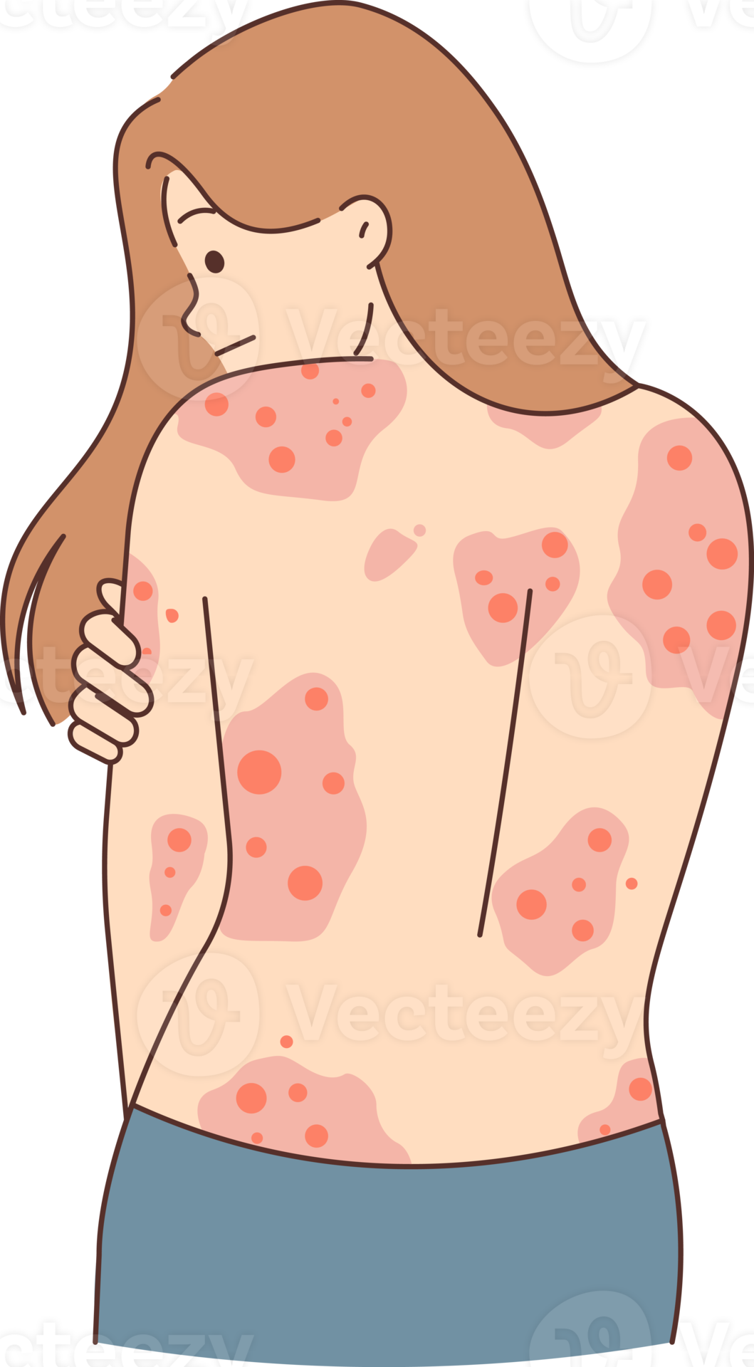 Free Unhealthy Woman Show Red Rash On Back 21477804 PNG With free-unhealthy-woman-show-red-rash-on-back-21477804-png-with