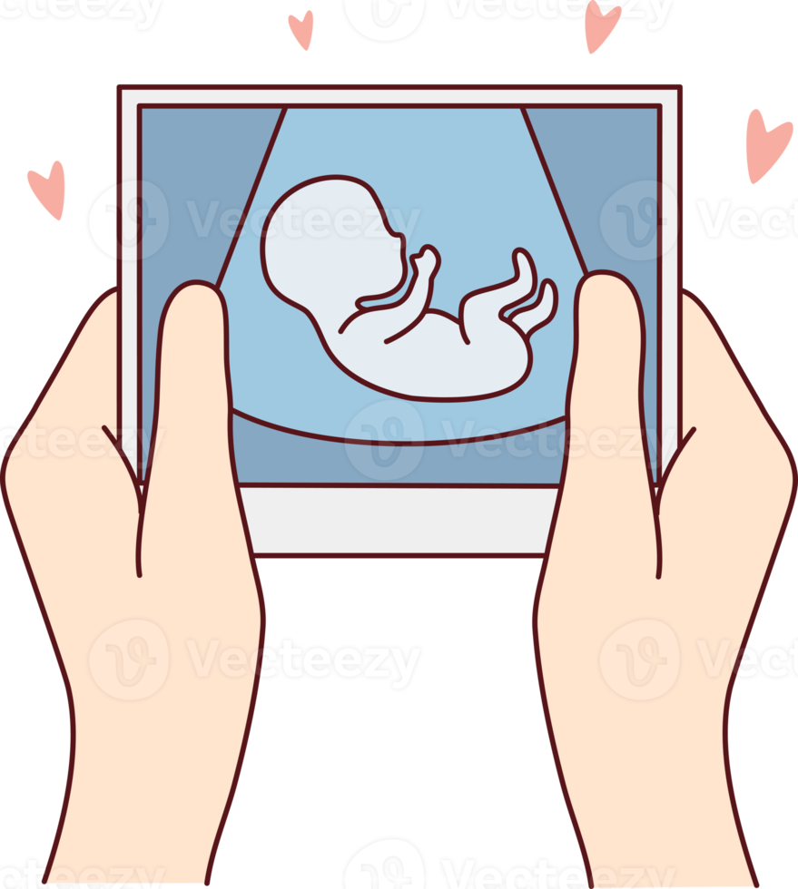 Future mother hold scan of embryo png