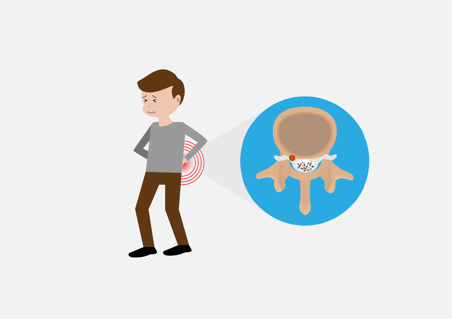 Young man suffering from herniated disc with back pain 21485971 Vector