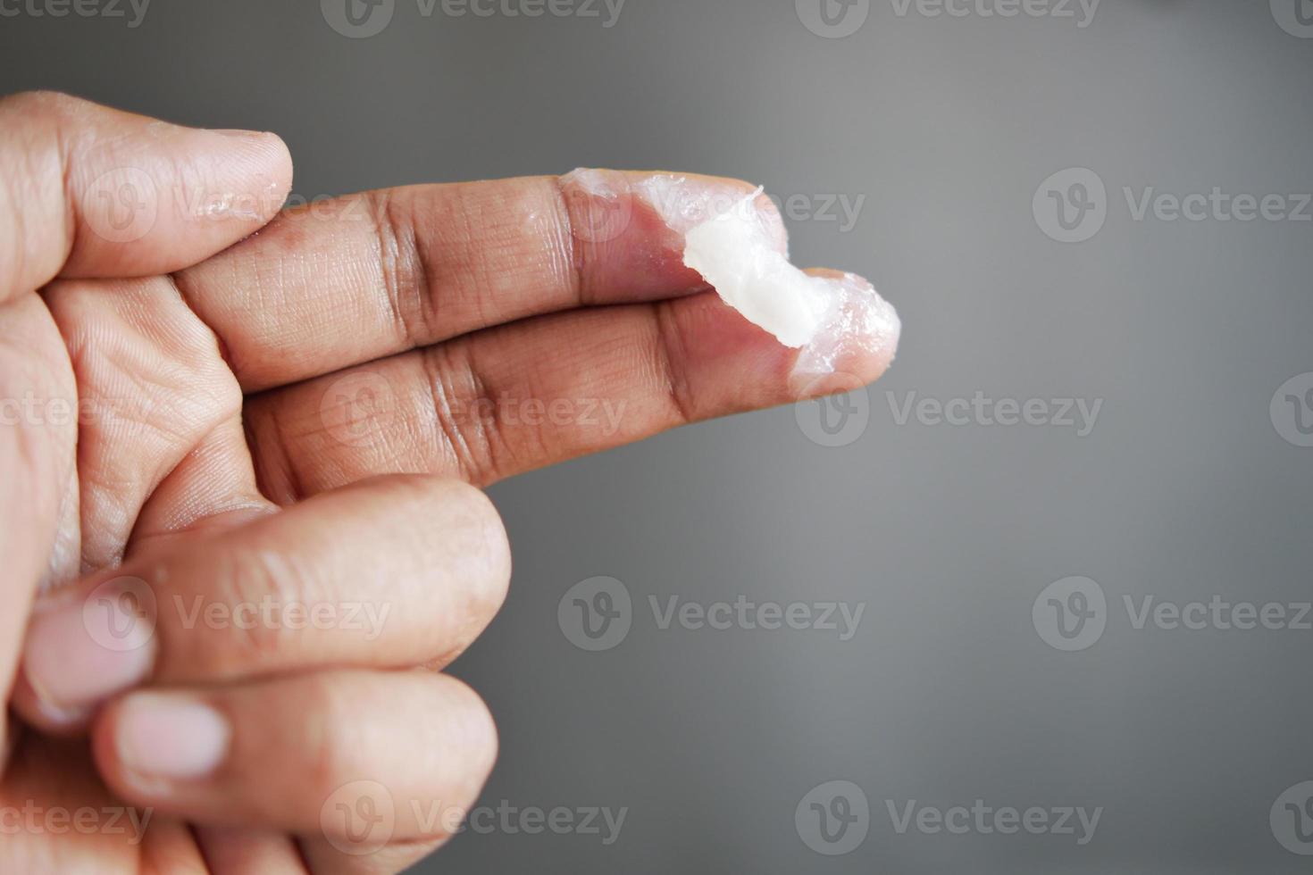 Close up of man hand using petroleum jelly photo