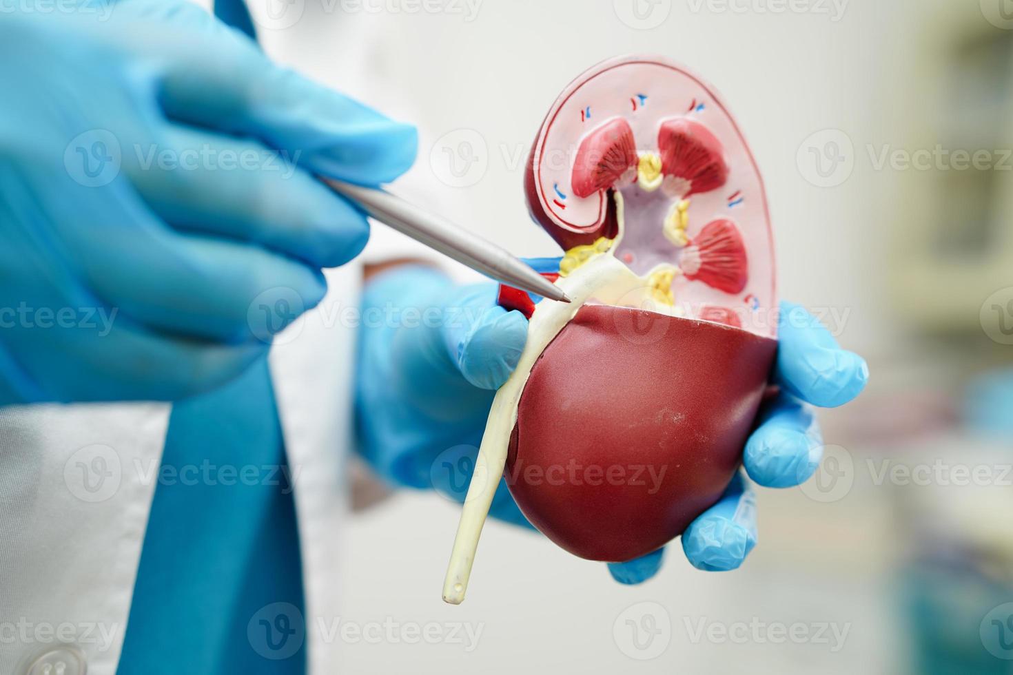 Chronic kidney disease, doctor holding model for treatment urinary system, urology, Estimated glomerular filtration rate eGFR. photo