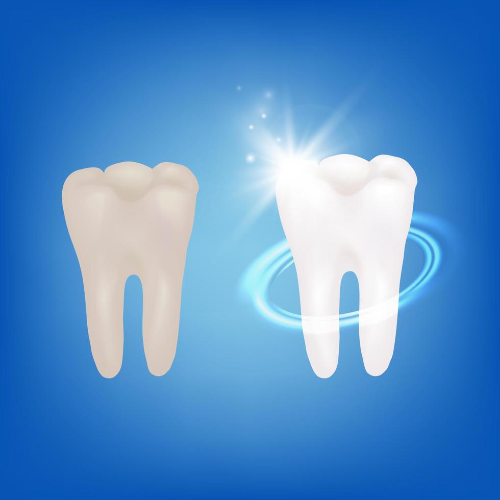 Realistic Detailed 3d Teeth Whitening Concept. Vector