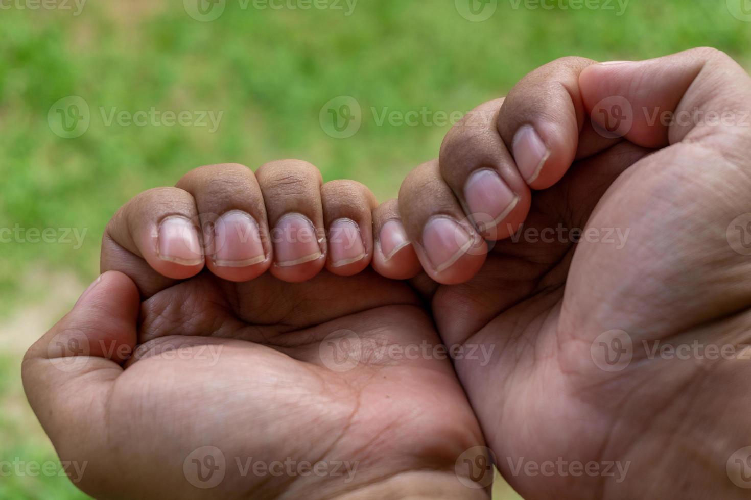 cerca arriba de largo dedo uñas necesitar a ser cortado. sano y cuerpo cuidado concepto foto