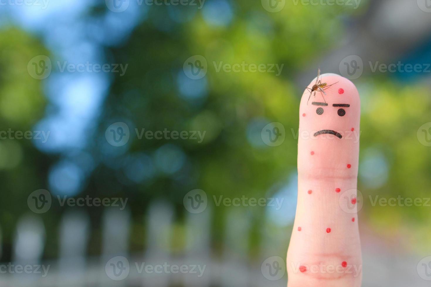 Finger art of man. Concept of human was bitten by mosquito. photo