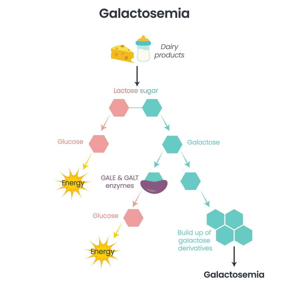 Galactosemia GALE GALK GALT Enzymatic Deficiency science vector illustration infographic