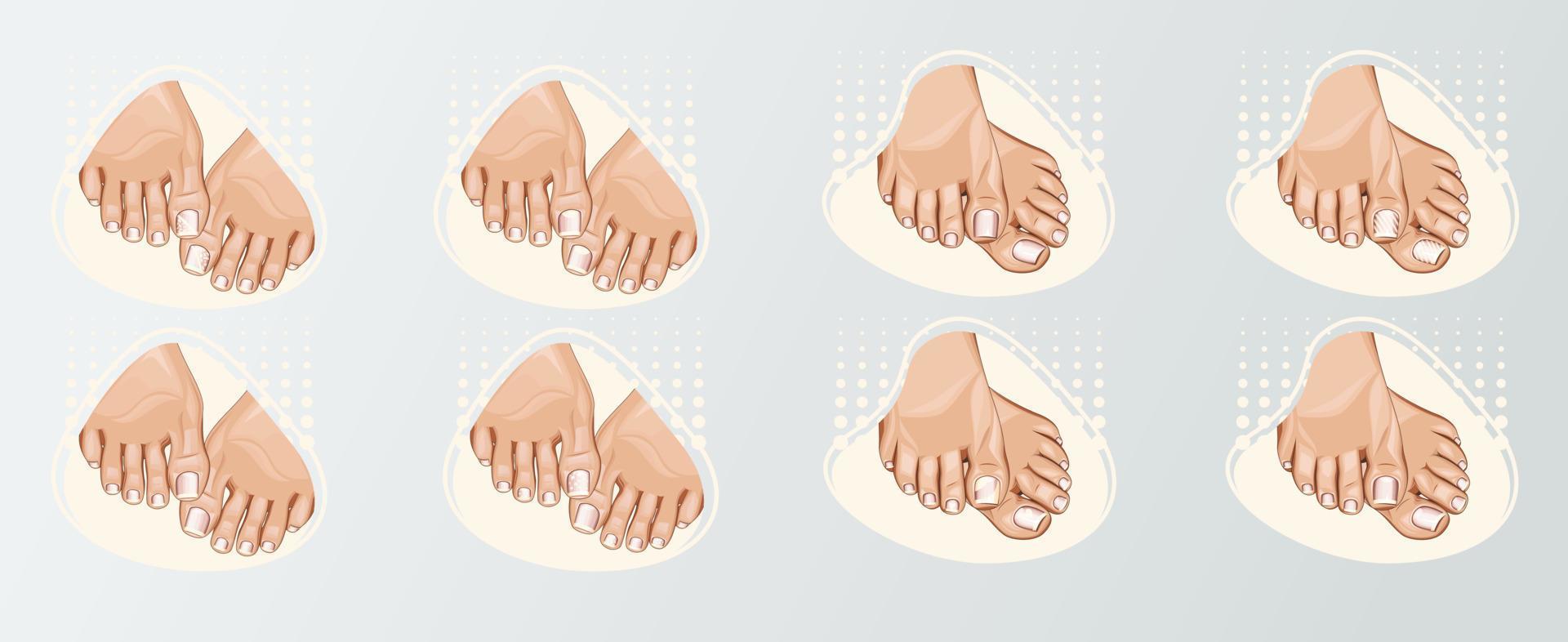 pedicure logo recopilación, hermosa hembra piernas con pedicure. Moda y belleza ilustración para belleza salón, uña tecnología vector