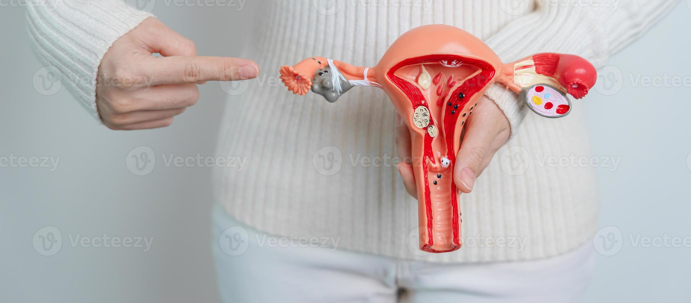 mujer sosteniendo modelo de útero y ovarios. cáncer de ovario y de cuello uterino, trastorno del cuello uterino, endometriosis, histerectomía, fibromas uterinos, sistema reproductivo y concepto de embarazo foto