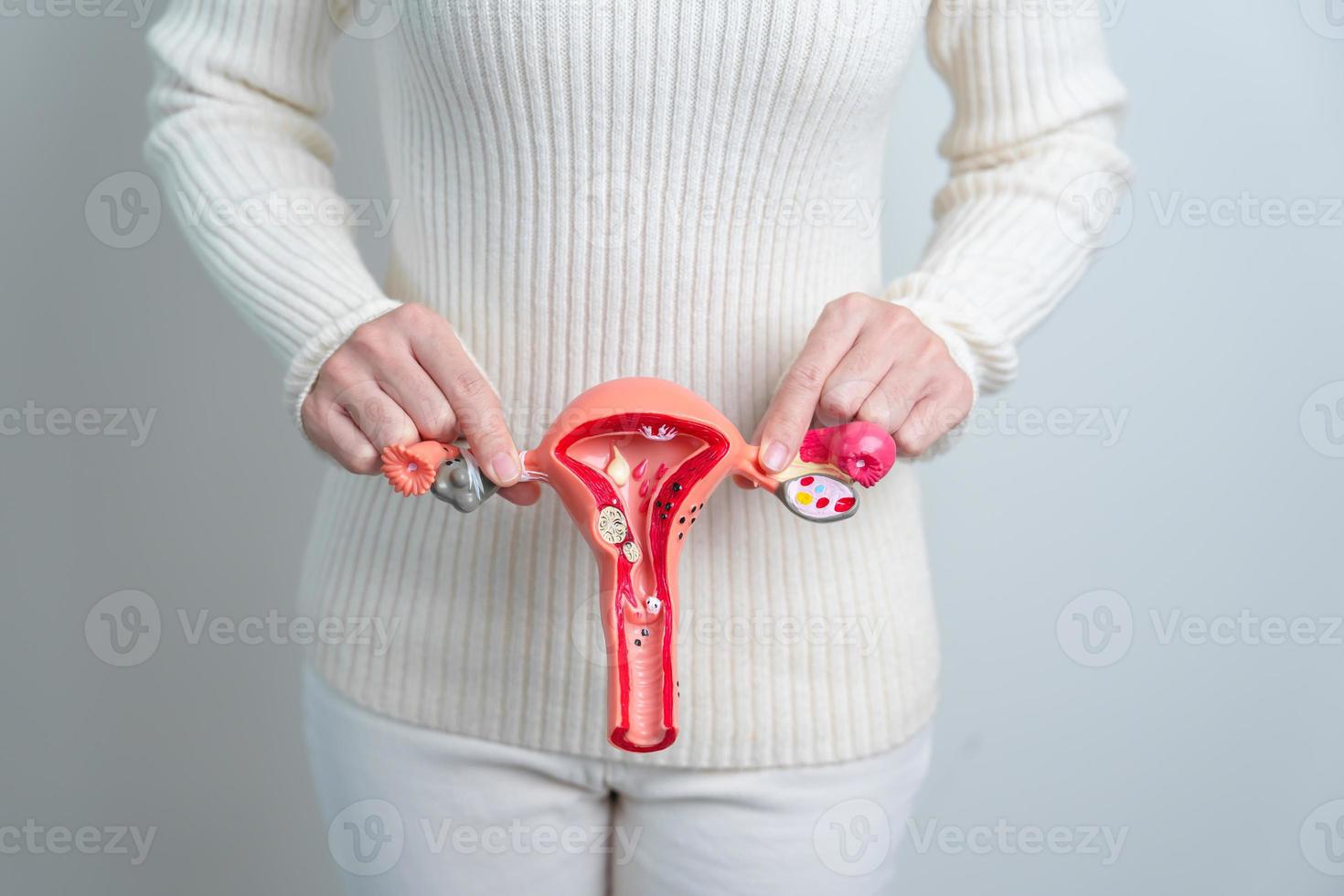 mujer sosteniendo modelo de útero y ovarios. cáncer de ovario y de cuello uterino, trastorno del cuello uterino, endometriosis, histerectomía, fibromas uterinos, sistema reproductivo y concepto de embarazo foto