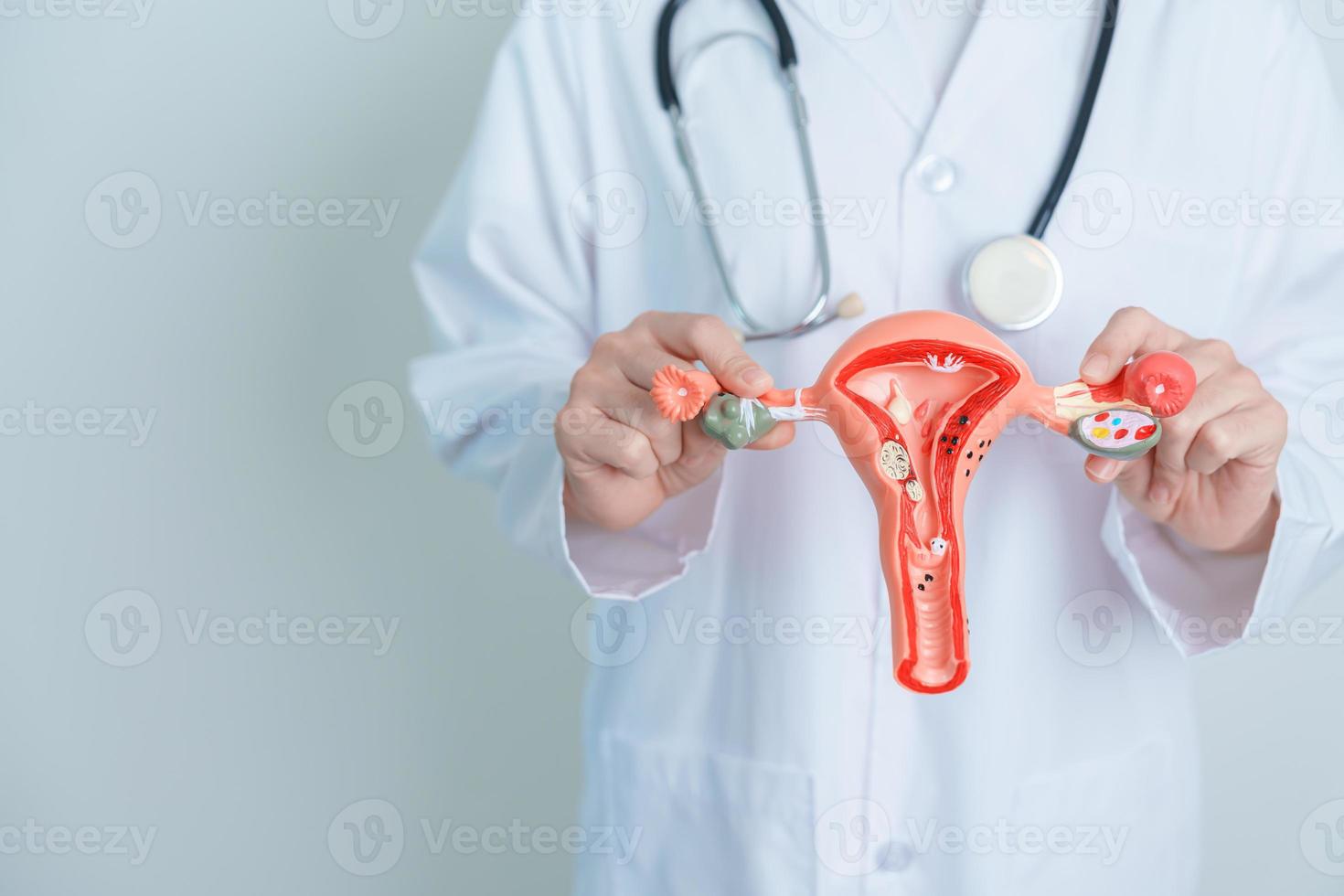 doctor sosteniendo modelo de útero y ovarios. cáncer de ovario y de cuello uterino, trastorno del cuello uterino, endometriosis, histerectomía, fibromas uterinos, sistema reproductivo y concepto de embarazo foto