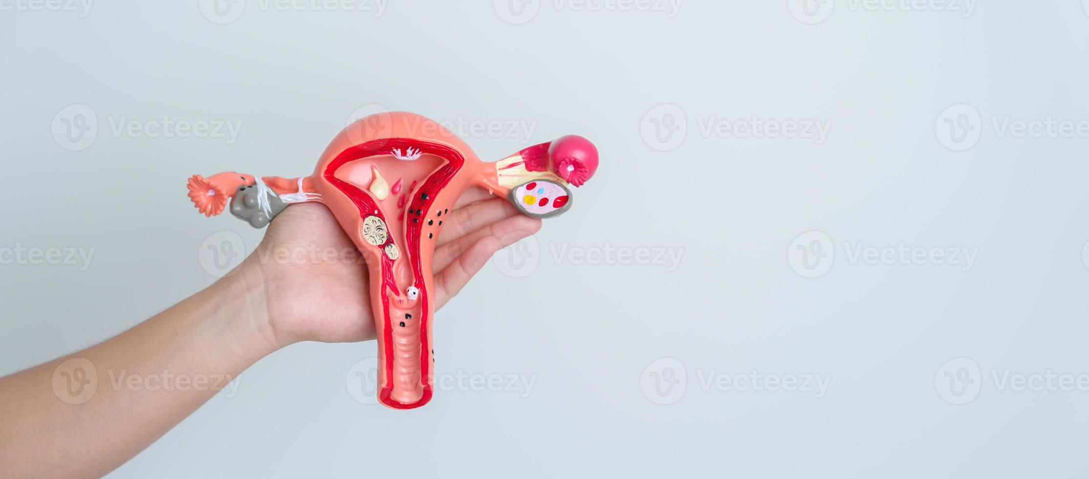 mujer sosteniendo modelo de útero y ovarios. cáncer de ovario y de cuello uterino, trastorno del cuello uterino, endometriosis, histerectomía, fibromas uterinos, sistema reproductivo y concepto de embarazo foto