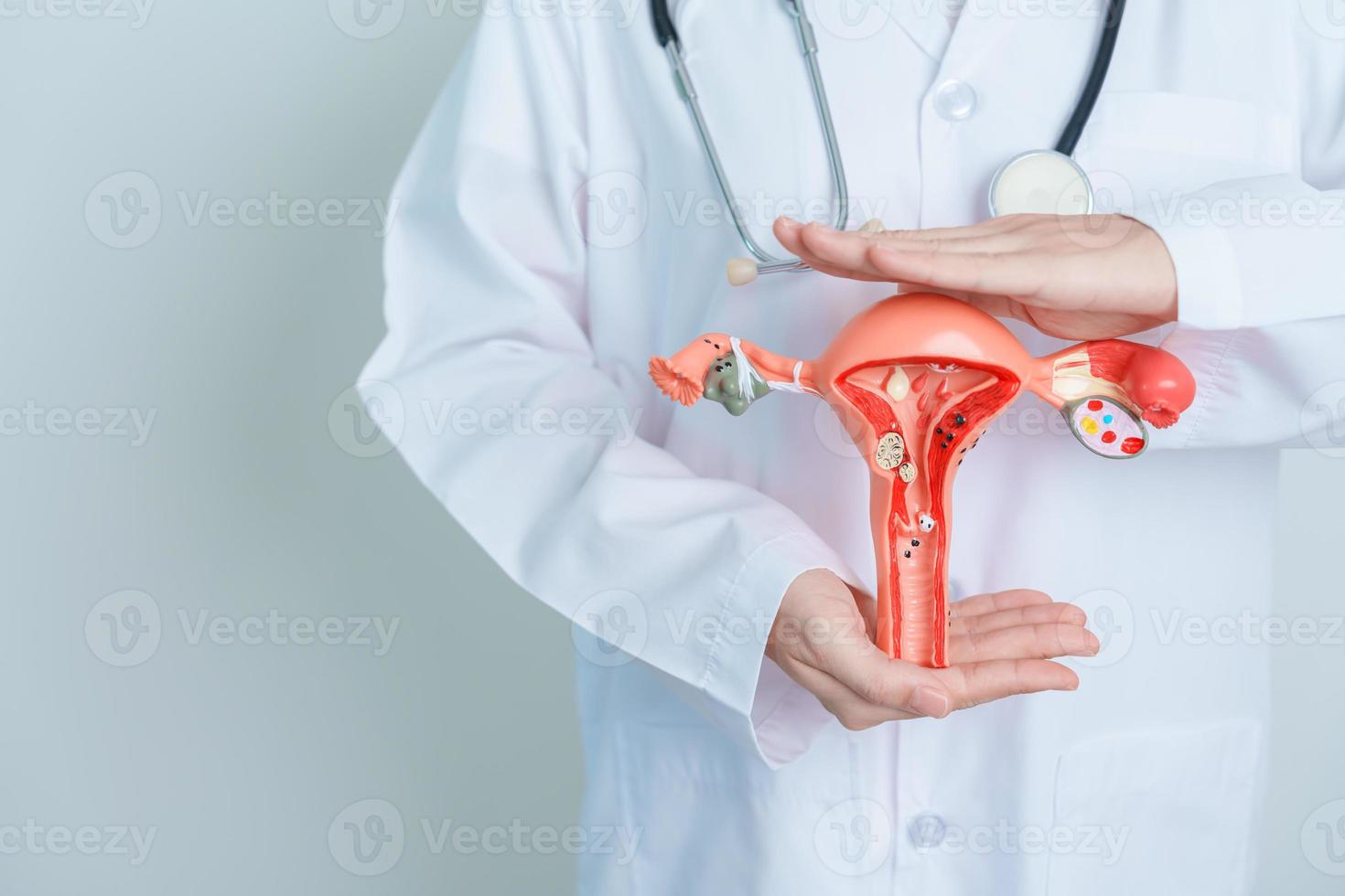 doctor sosteniendo modelo de útero y ovarios. cáncer de ovario y de cuello uterino, trastorno del cuello uterino, endometriosis, histerectomía, fibromas uterinos, sistema reproductivo y concepto de embarazo foto