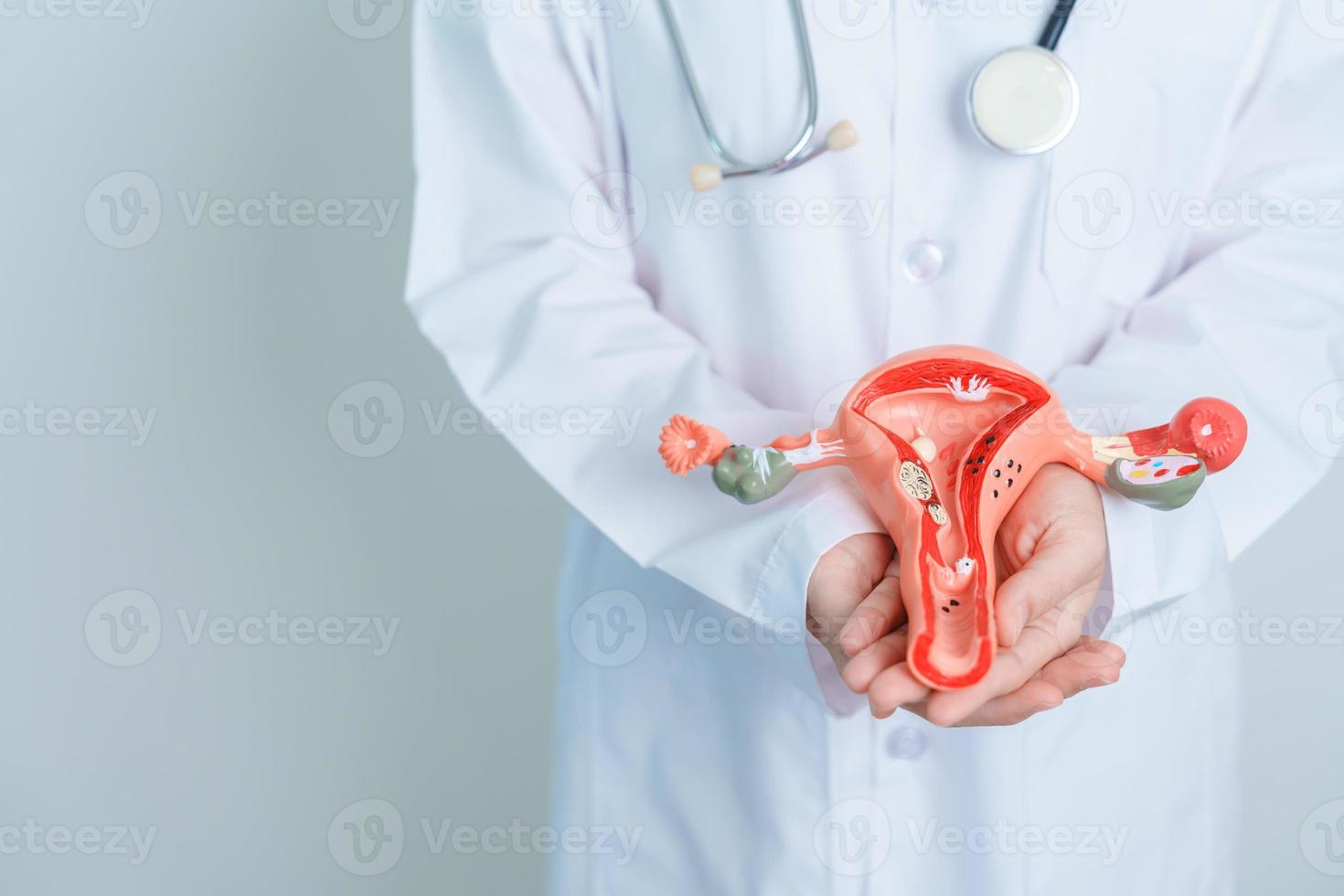 doctor sosteniendo modelo de útero y ovarios. cáncer de ovario y de cuello uterino, trastorno del cuello uterino, endometriosis, histerectomía, fibromas uterinos, sistema reproductivo y concepto de embarazo foto