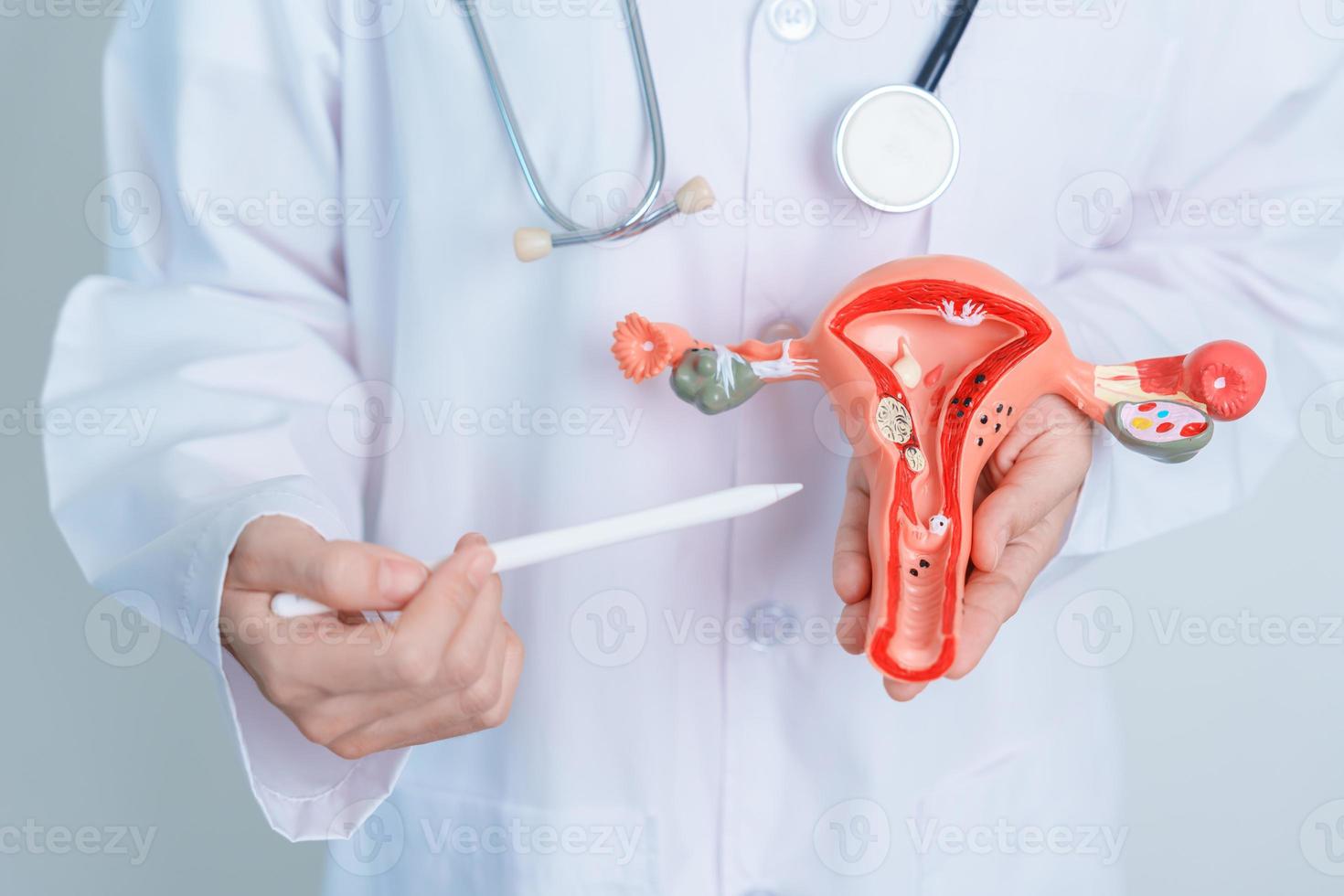 Doctor holding Uterus and Ovaries model. Ovarian and Cervical cancer, Cervix disorder, Endometriosis, Hysterectomy, Uterine fibroids, Reproductive system and Pregnancy concept photo