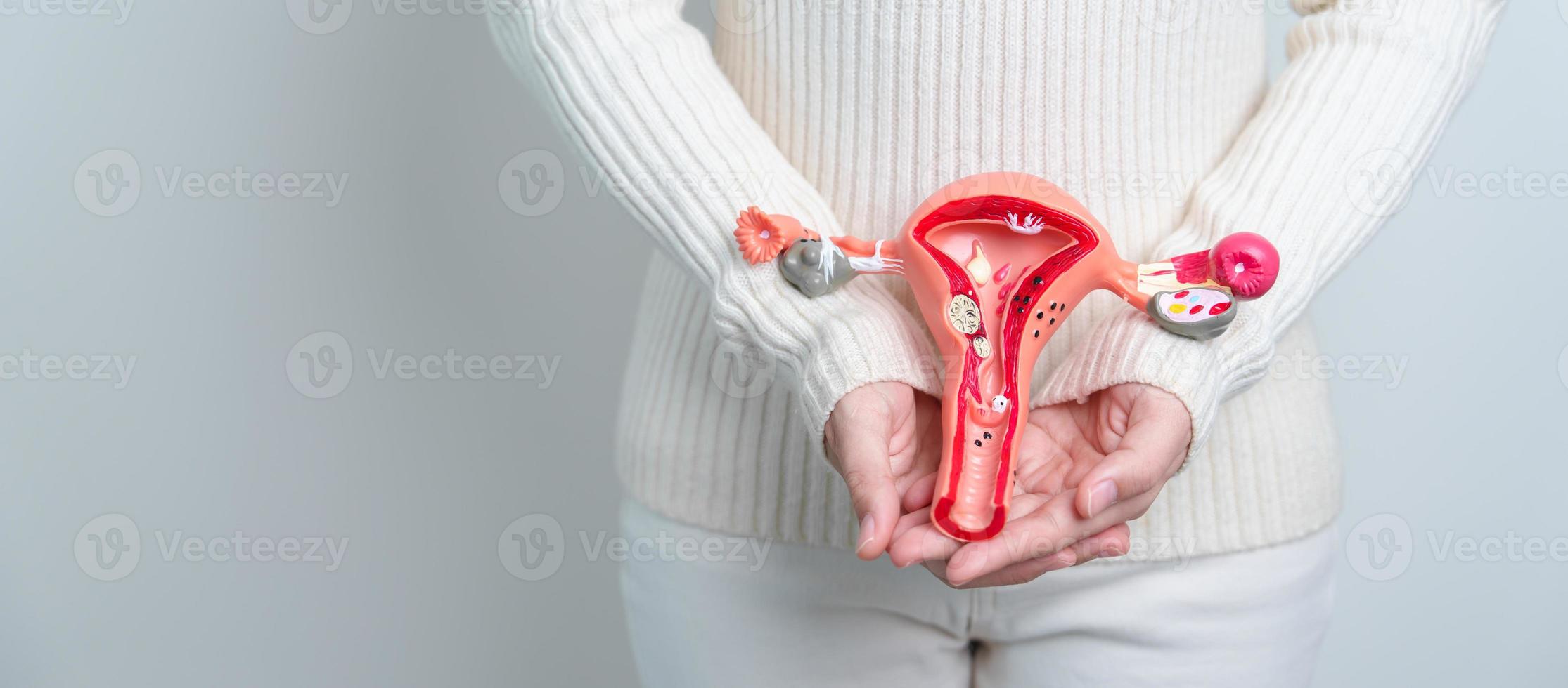 mujer sosteniendo modelo de útero y ovarios. cáncer de ovario y de cuello uterino, trastorno del cuello uterino, endometriosis, histerectomía, fibromas uterinos, sistema reproductivo y concepto de embarazo foto