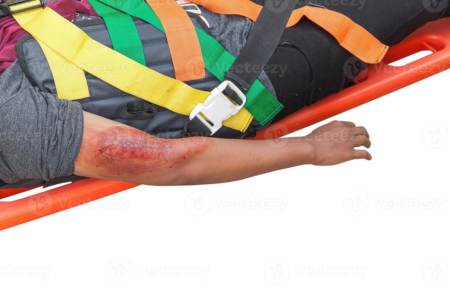patient Injury upper arm in stretcher isolated on white background and clipping path photo
