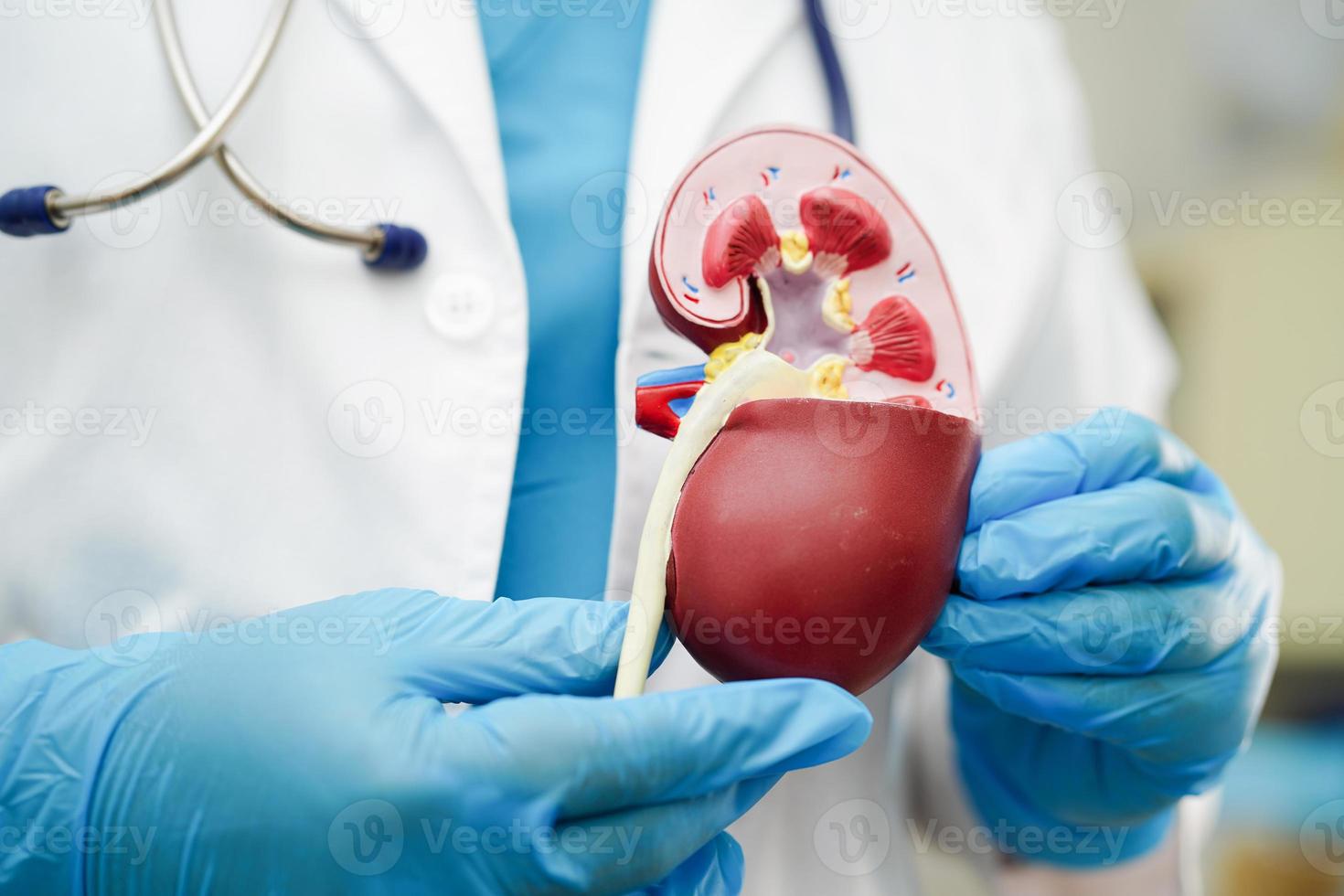 Chronic kidney disease, doctor holding model for treatment urinary system, urology, Estimated glomerular filtration rate eGFR. photo