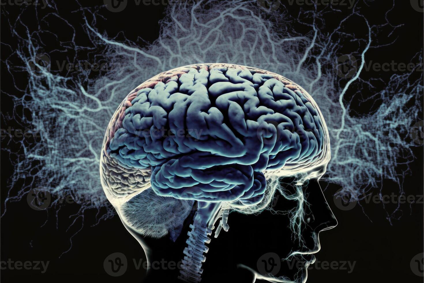 ai generado estrés o neurona en el cerebro. neurología concepto. foto